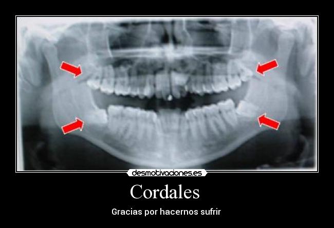 Cordales - Gracias por hacernos sufrir