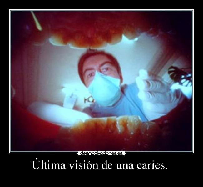 Última visión de una caries.  - 