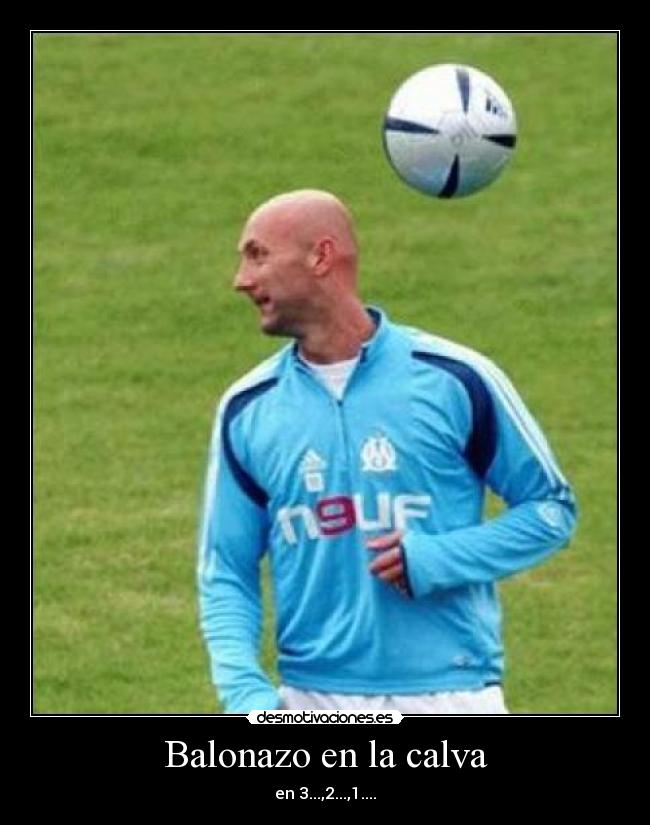 Balonazo en la calva - en 3...,2...,1....