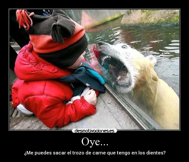 Oye... - ¿Me puedes sacar el trozo de carne que tengo en los dientes?