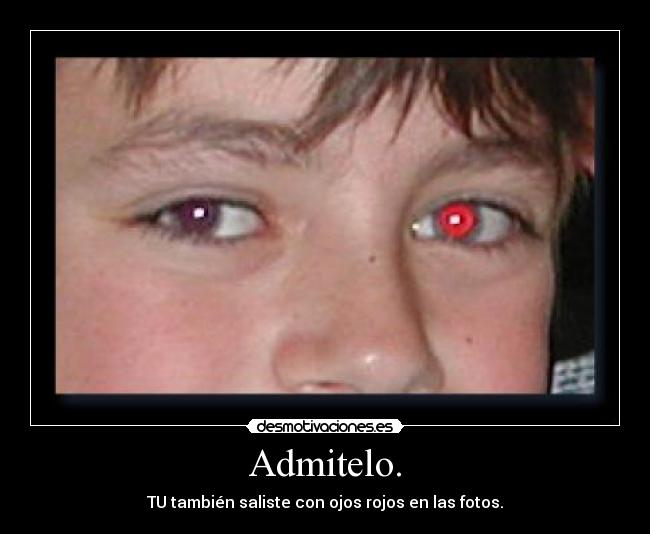 Admitelo. - TU también saliste con ojos rojos en las fotos.