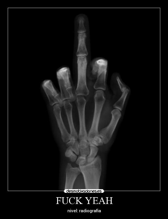 carteles radiografia fuck yeah lordny desmotivaciones