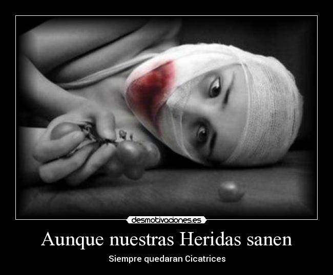 Aunque nuestras Heridas sanen - Siempre quedaran Cicatrices