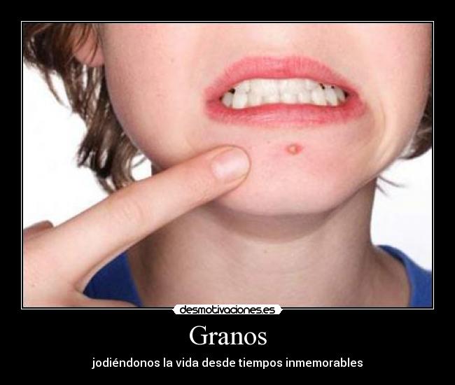Granos - 