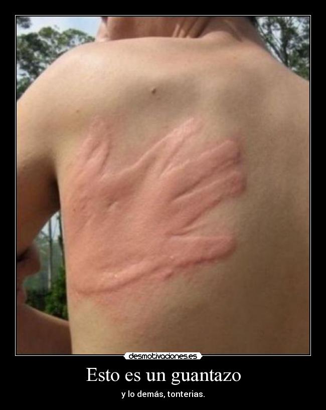 Esto es un guantazo - y lo demás, tonterias.