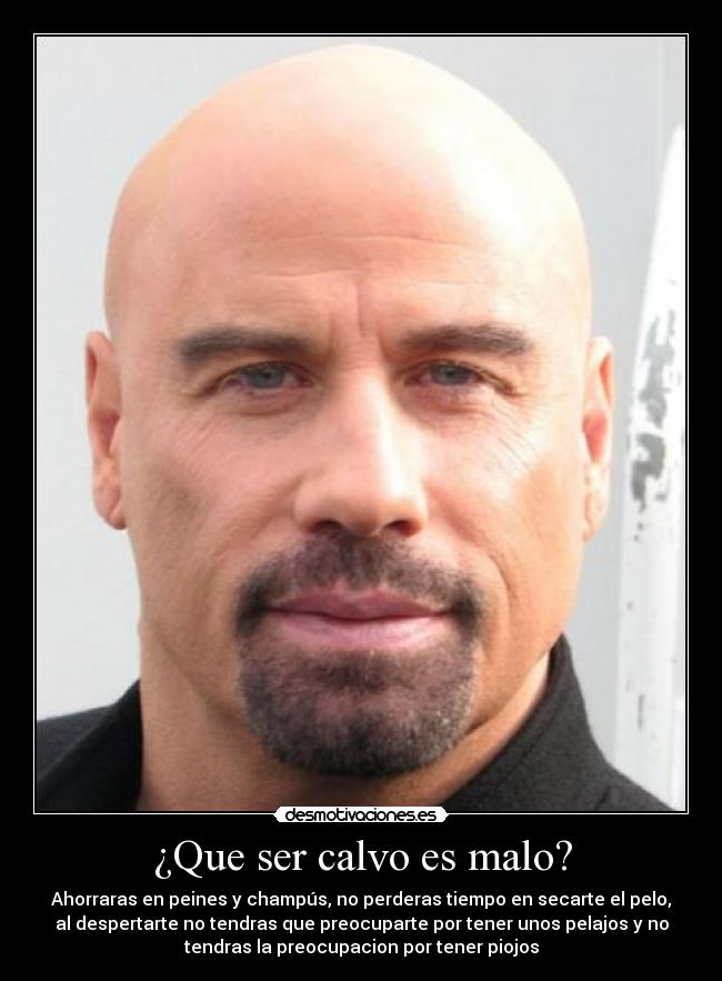 ¿Que ser calvo es malo? -