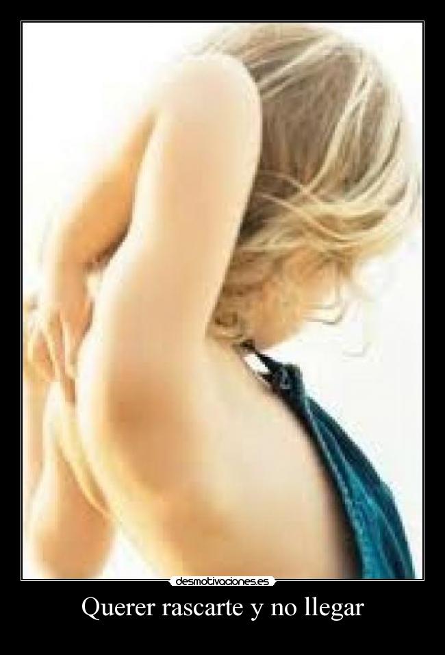 Querer rascarte y no llegar -