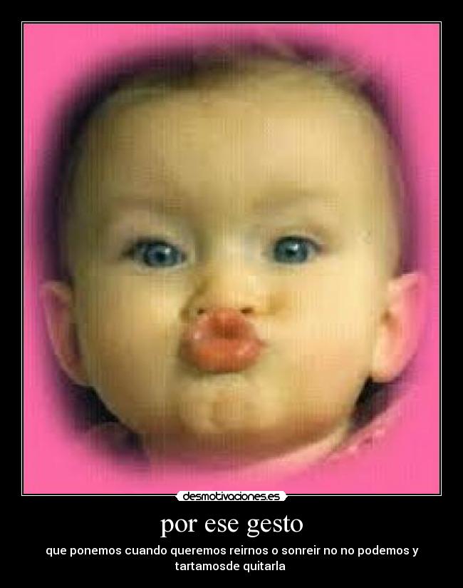 por ese gesto - que ponemos cuando queremos reirnos o sonreir no no podemos y
tartamosde quitarla