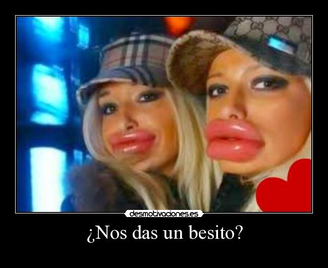 ¿Nos das un besito? -