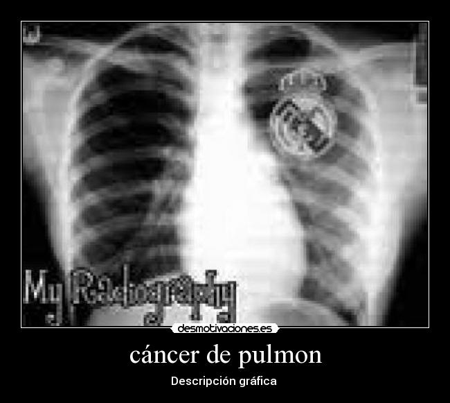 cáncer de pulmon - Descripción gráfica 