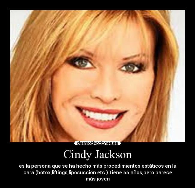Cindy Jackson - es la persona que se ha hecho más procedimientos estáticos en la
cara (bótox,liftings,liposucción etc.).Tiene 55 años,pero parece
más joven