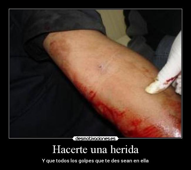Hacerte una herida -