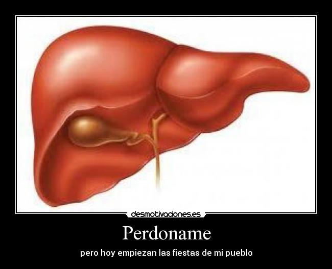 carteles perdoname desmotivaciones