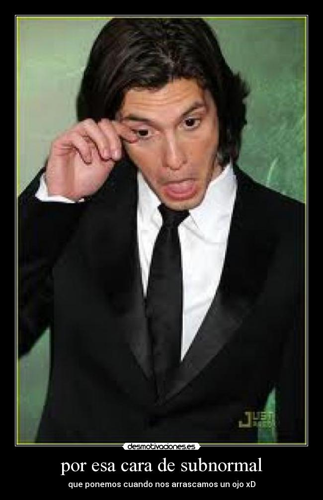 por esa cara de subnormal - que ponemos cuando nos arrascamos un ojo xD