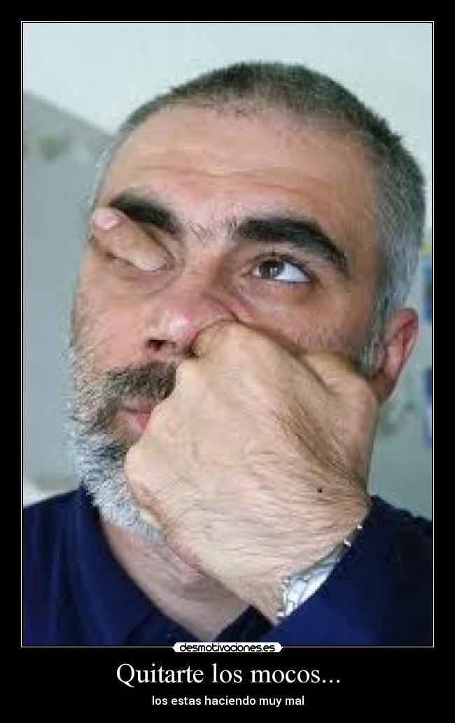 Quitarte los mocos... - 