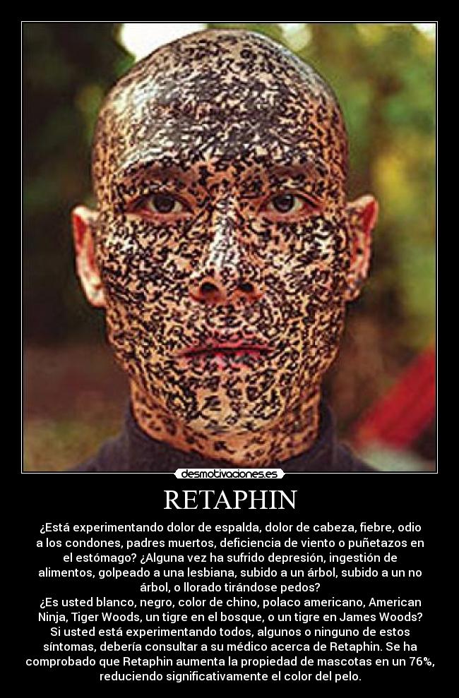 RETAPHIN - ¿Está experimentando dolor de espalda, dolor de cabeza, fiebre, odio
a los condones, padres muertos, deficiencia de viento o puñetazos en
el estómago? ¿Alguna vez ha sufrido depresión, ingestión de
alimentos, golpeado a una lesbiana, subido a un árbol, subido a un no
árbol, o llorado tirándose pedos?
¿Es usted blanco, negro, color de chino, polaco americano, American
Ninja, Tiger Woods, un tigre en el bosque, o un tigre en James Woods?
Si usted está experimentando todos, algunos o ninguno de estos
síntomas, debería consultar a su médico acerca de Retaphin. Se ha
comprobado que Retaphin aumenta la propiedad de mascotas en un 76%,
reduciendo significativamente el color del pelo.