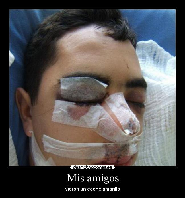 Mis amigos - vieron un coche amarillo