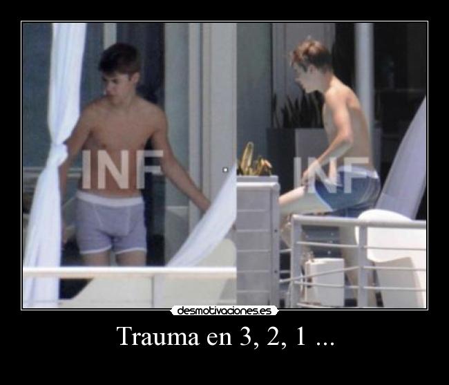 Trauma en 3, 2, 1 ... - 