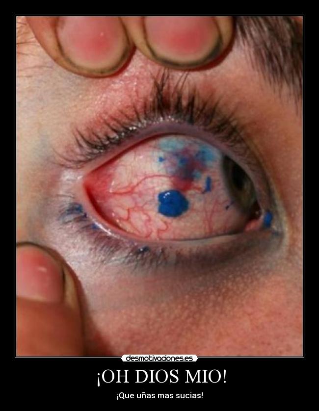 ¡OH DIOS MIO! - ¡Que uñas mas sucias!