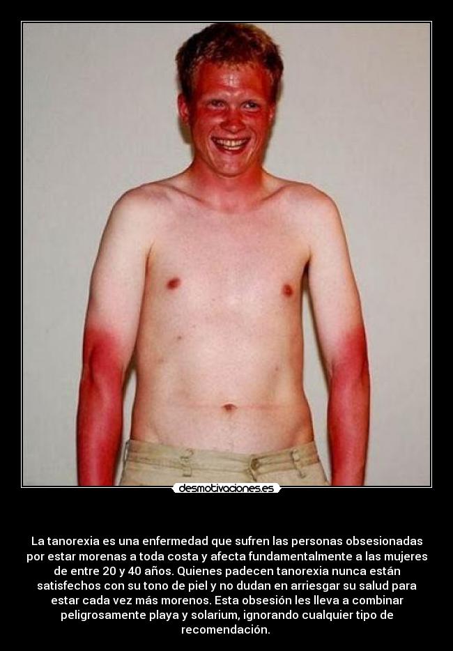   - La tanorexia es una enfermedad que sufren las personas obsesionadas
por estar morenas a toda costa y afecta fundamentalmente a las mujeres
de entre 20 y 40 años. Quienes padecen tanorexia nunca están
satisfechos con su tono de piel y no dudan en arriesgar su salud para
estar cada vez más morenos. Esta obsesión les lleva a combinar
peligrosamente playa y solarium, ignorando cualquier tipo de
recomendación. 