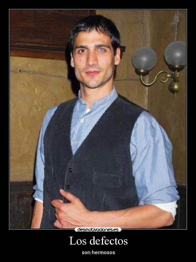 Los defectos - son hermosos