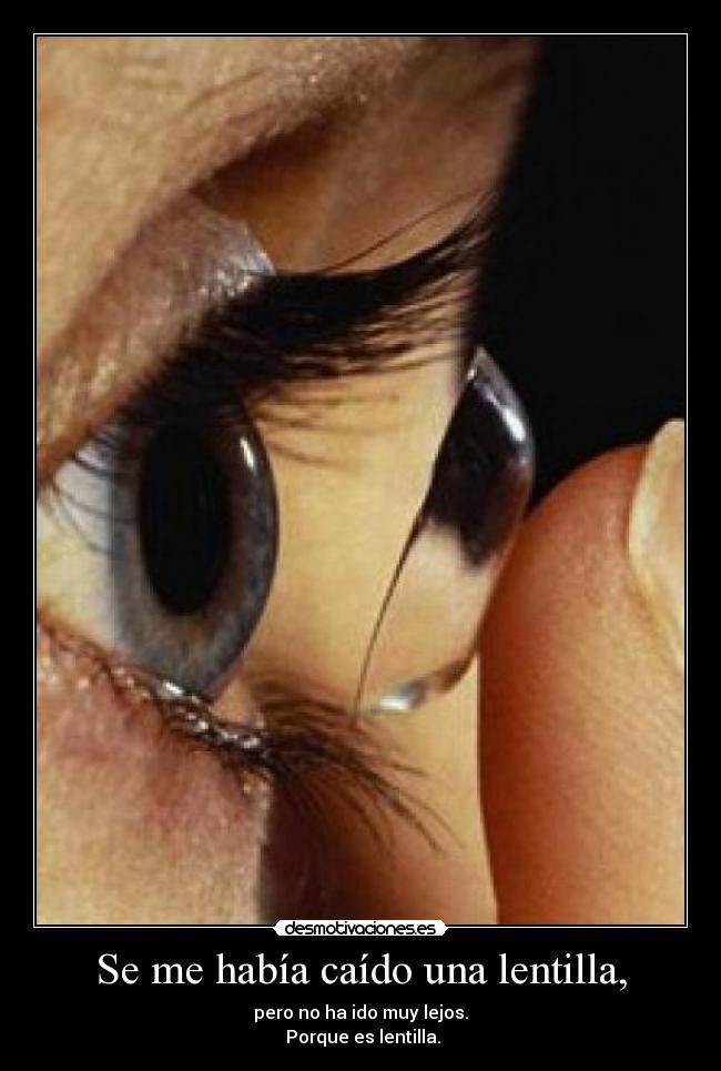 Se me había caído una lentilla, -