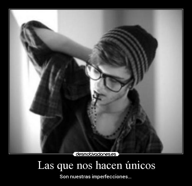 Las que nos hacen únicos - Son nuestras imperfecciones... 