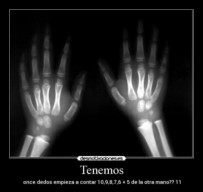 Tenemos -