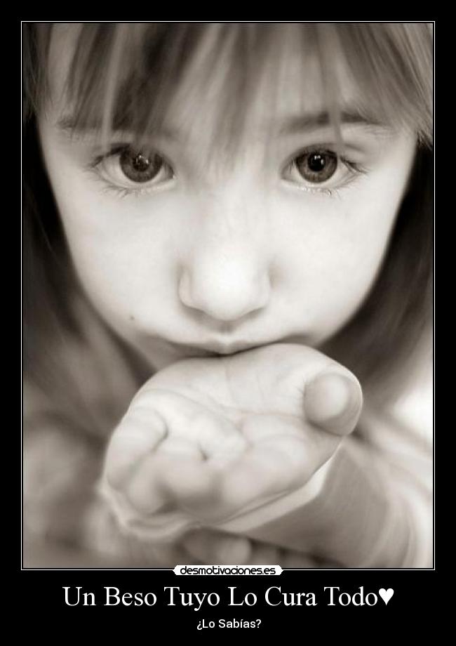 Un Beso Tuyo Lo Cura Todo♥ - ¿Lo Sabías?