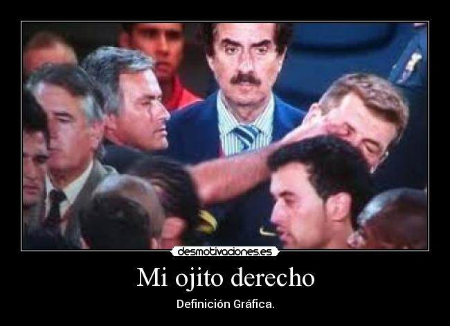 Mi ojito derecho -