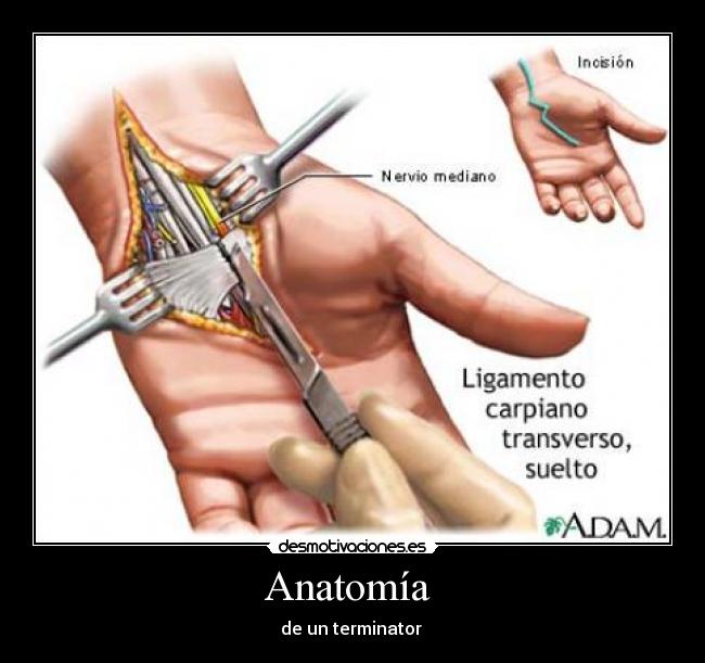 Anatomía  - de un terminator 