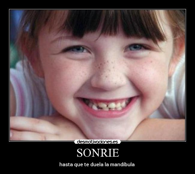 SONRIE - hasta que te duela la mandíbula