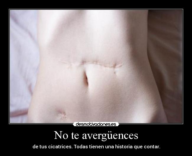 No te avergüences - 