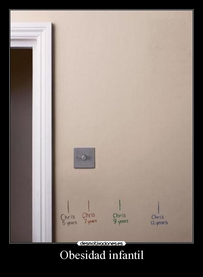 Obesidad infantil - 