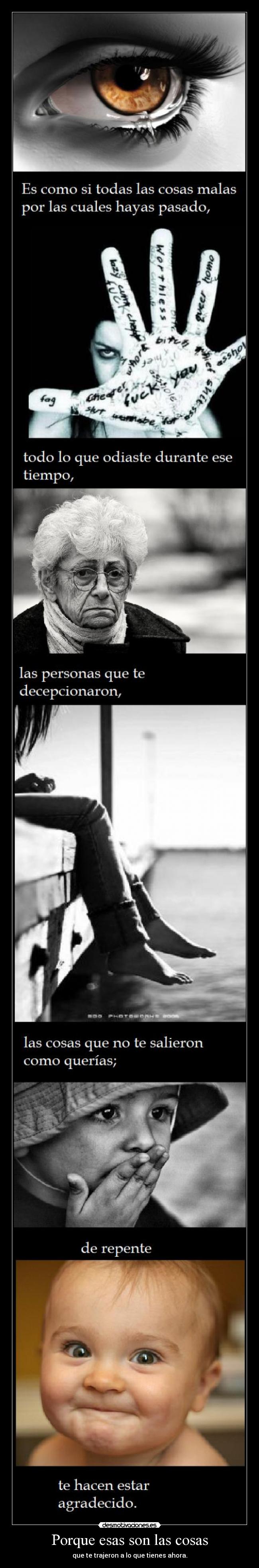 Porque esas son las cosas -