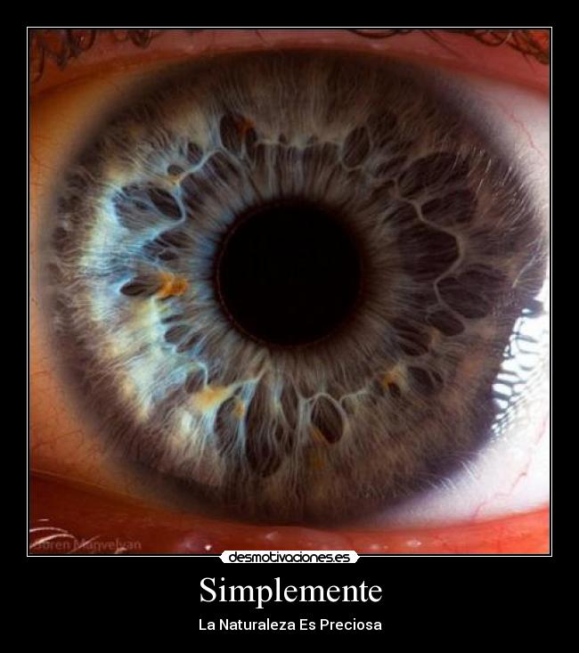 Simplemente -