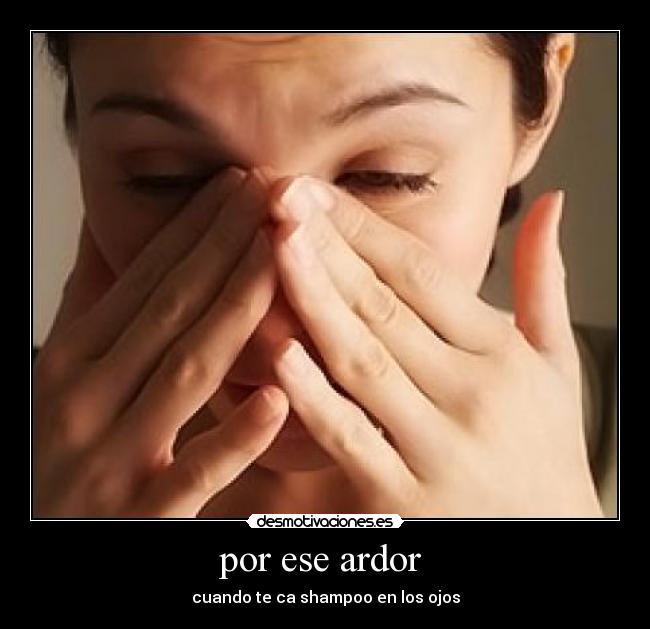 por ese ardor  - 