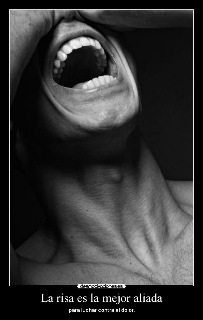 La risa es la mejor aliada -