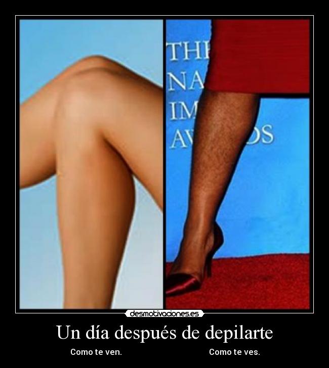 Un día después de depilarte - Como te ven. Como te ves.