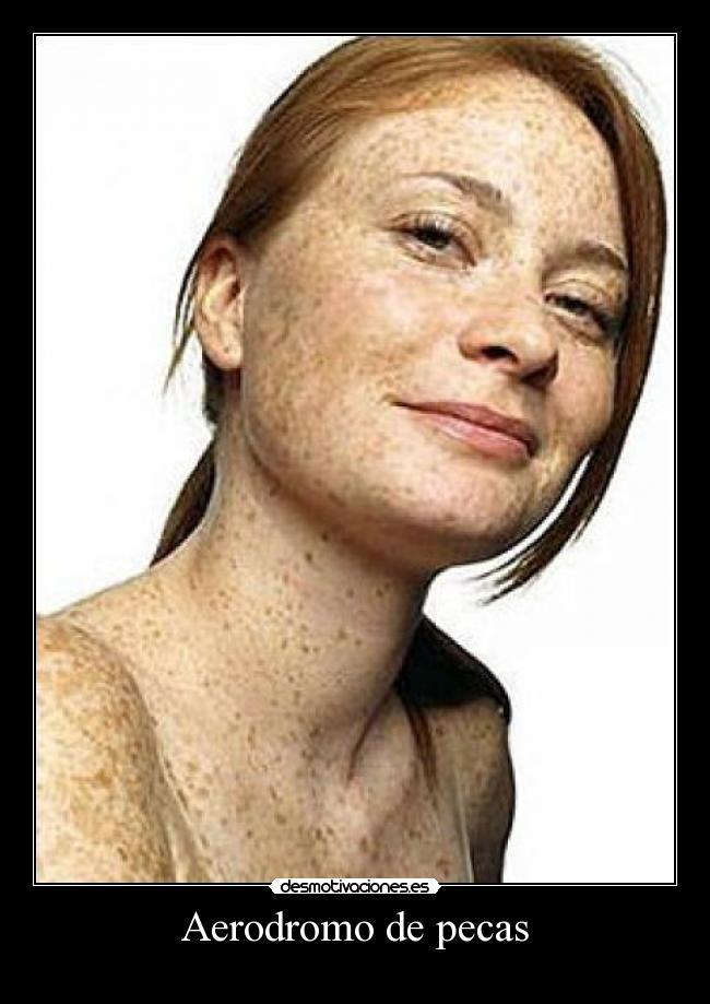 Aerodromo de pecas -