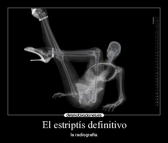 El estriptís definitivo - la radiografía.