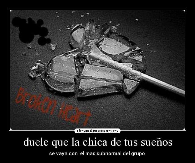 duele que la chica de tus sueños -