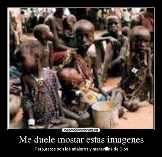 Me duele mostar estas imagenes - Pero,estos son los mialgros y maravillas de Dios
