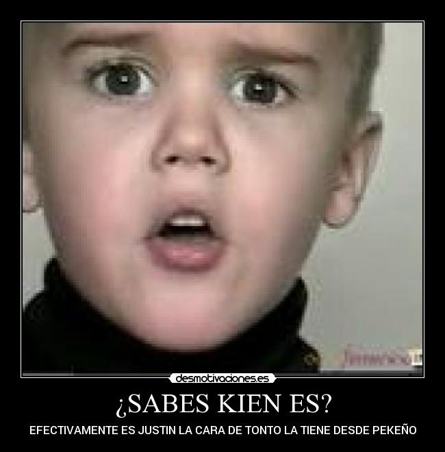 ¿SABES KIEN ES? - EFECTIVAMENTE ES JUSTIN LA CARA DE TONTO LA TIENE DESDE PEKEÑO