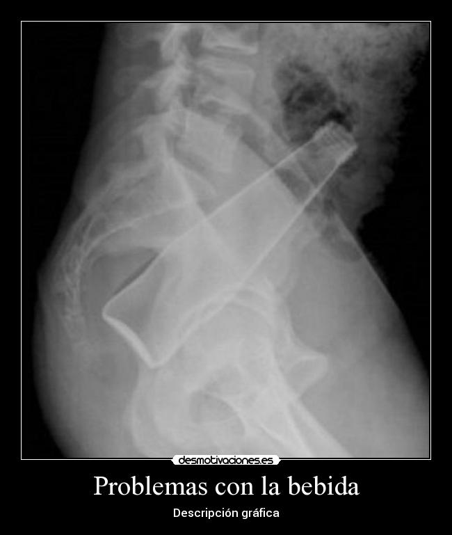 carteles problemas eften desmotivaciones