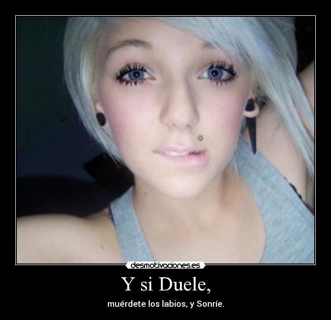 Y si Duele, -