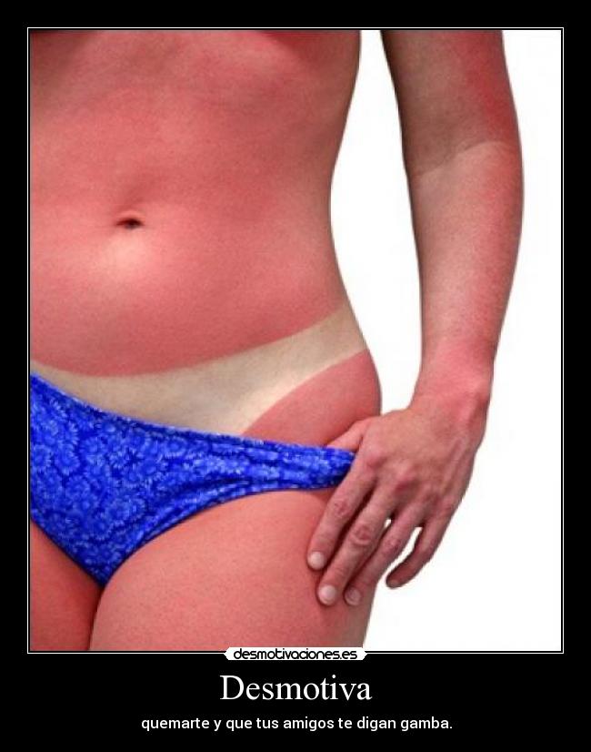 Desmotiva - quemarte y que tus amigos te digan gamba.