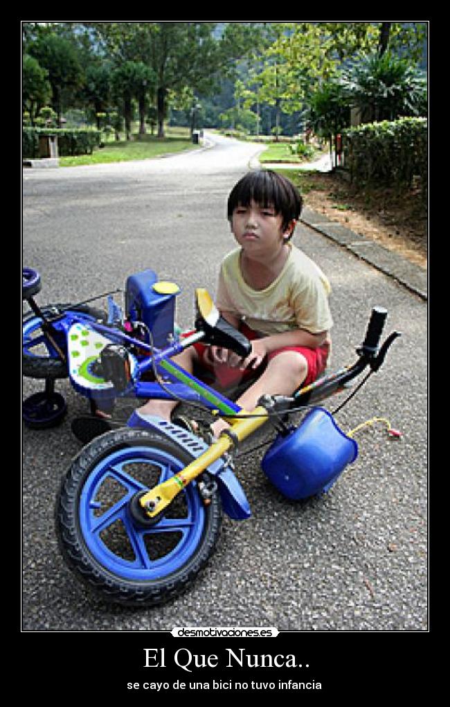 El Que Nunca.. - se cayo de una bici no tuvo infancia