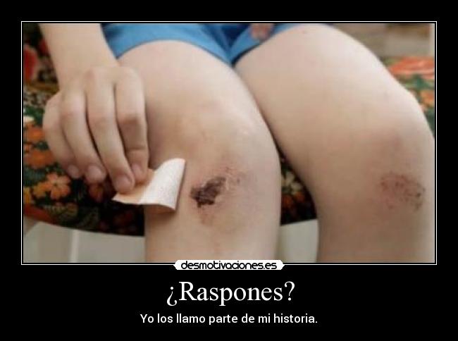 ¿Raspones? - Yo los llamo parte de mi historia.