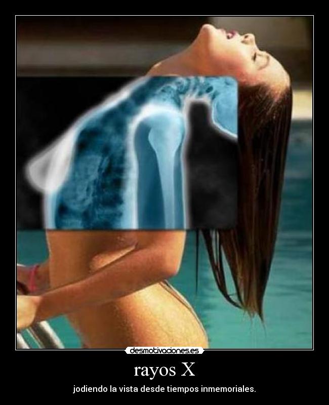 rayos X - jodiendo la vista desde tiempos inmemoriales.